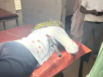 युवती पर चाकू से हमला कर भागे बदमाश